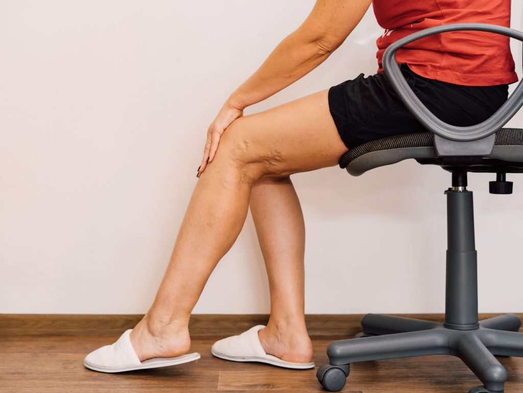vein health