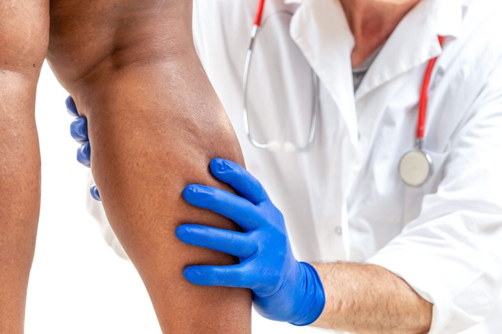 Vein disease diagnosis treatment Ohio