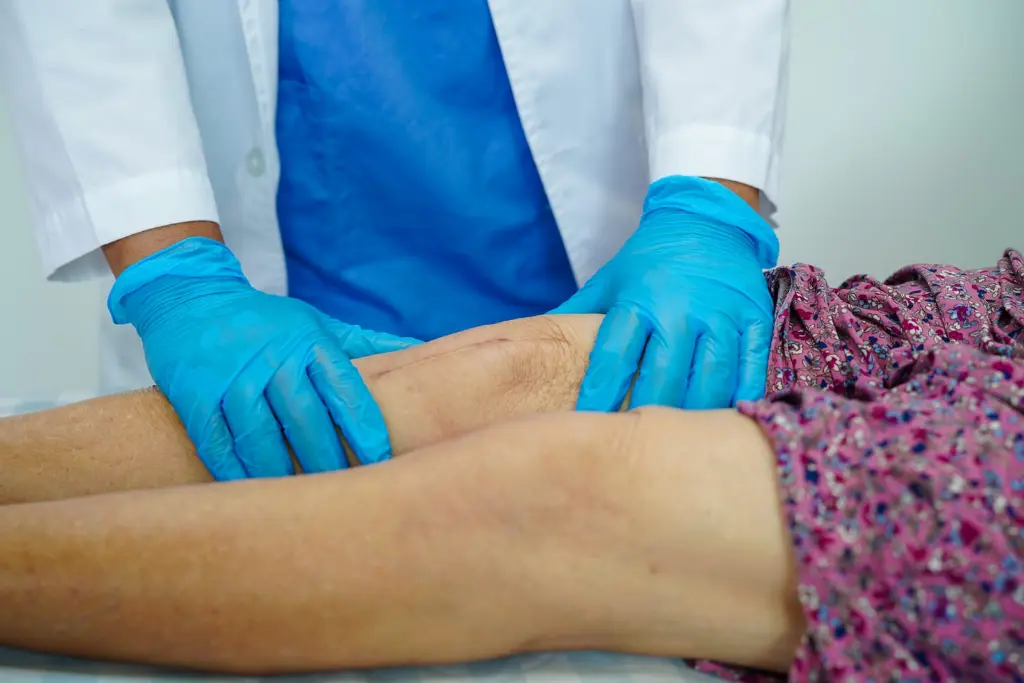 Knee replacement and the risk of clots